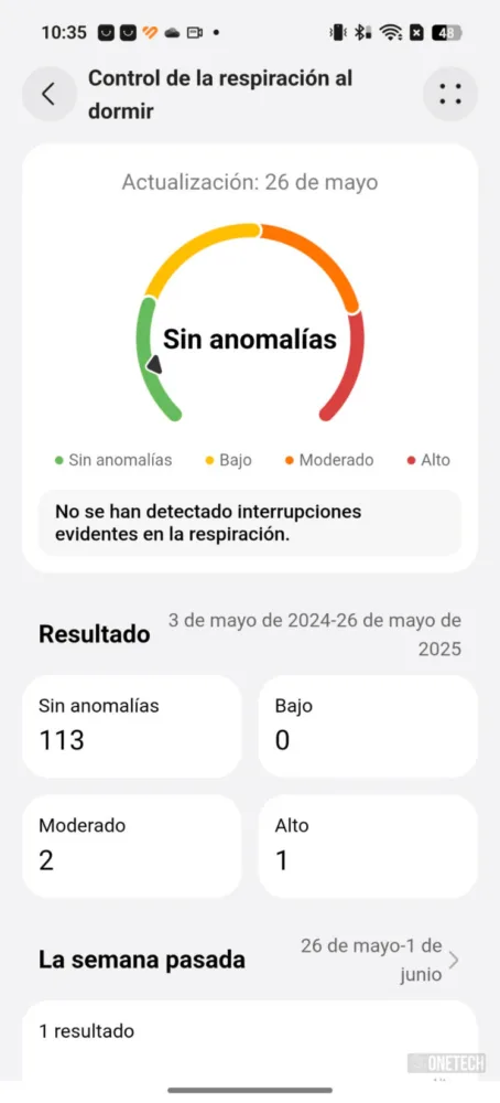 Huawei Watch 5, el smartwatch con el que Huawei quiere "humillar" a la competencia - Análisis Huawei Watch 5, el smartwatch con el que Huawei quiere "humillar" a la competencia - Análisis