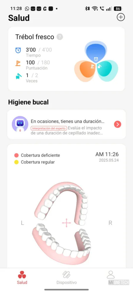 Oclean X Ultra 20 S, el cepillo inteligente que te enseña a cepillarte los dientes - Análisis Oclean X Ultra 20 S, el cepillo inteligente que te enseña a cepillarte los dientes - Análisis