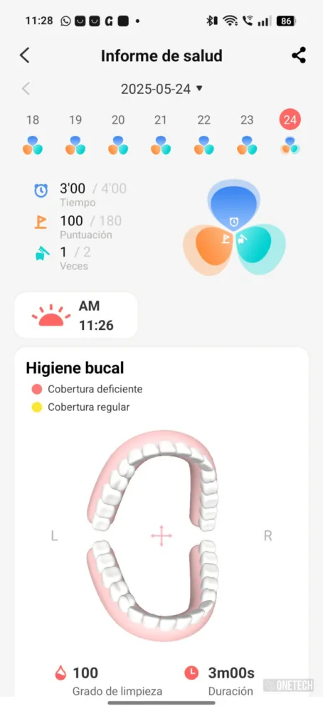 Oclean X Ultra 20 S, el cepillo inteligente que te enseña a cepillarte los dientes - Análisis Oclean X Ultra 20 S, el cepillo inteligente que te enseña a cepillarte los dientes - Análisis