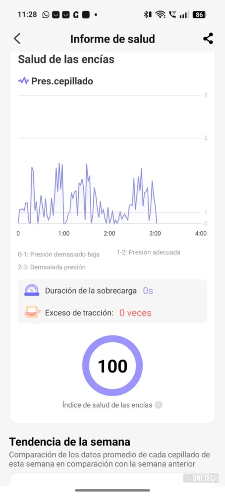 Oclean X Ultra 20 S, el cepillo inteligente que te enseña a cepillarte los dientes - Análisis Oclean X Ultra 20 S, el cepillo inteligente que te enseña a cepillarte los dientes - Análisis