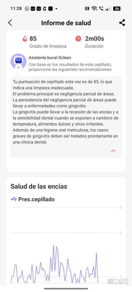 Oclean X Ultra 20 S, el cepillo inteligente que te enseña a cepillarte los dientes - Análisis Oclean X Ultra 20 S, el cepillo inteligente que te enseña a cepillarte los dientes - Análisis