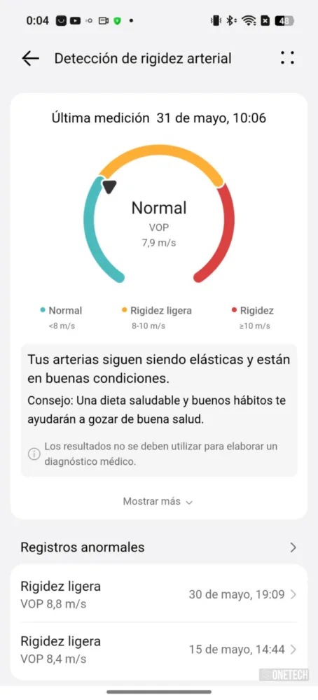 Huawei Watch Fit 4 Pro, una nueva generación que pone el listón muy alto - Análisis Huawei Watch Fit 4 Pro, una nueva generación que pone el listón muy alto - Análisis
