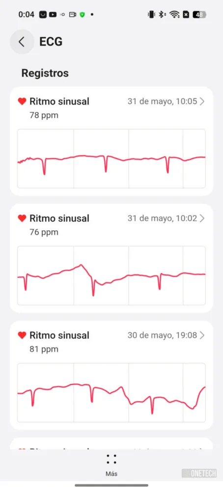 Huawei Watch Fit 4 Pro, una nueva generación que pone el listón muy alto - Análisis Huawei Watch Fit 4 Pro, una nueva generación que pone el listón muy alto - Análisis