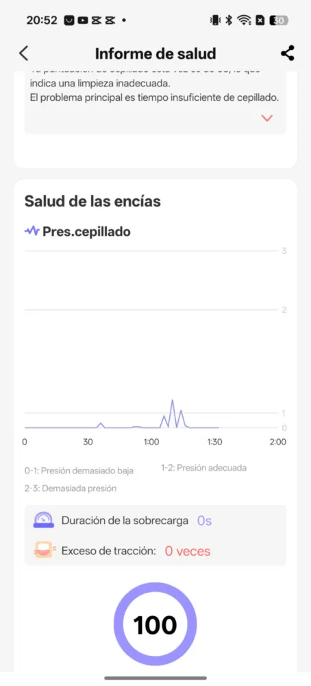 Probamos el Oclean X Pro 20 S, el cepillo dental sónico "inteligente" - Análisis